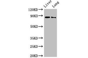 Western Blot Positive WB detected in: Rat liver tissue, Rat lung tissue All lanes: DENND1C antibody at 3 μg/mL Secondary Goat polyclonal to rabbit IgG at 1/50000 dilution Predicted band size: 88, 83 kDa Observed band size: 88 kDa (DENND1C antibody  (AA 601-801))