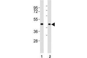 Western blot testing of CCR1 antibody at 1:2000 dilution. (CCR1 antibody  (AA 13-44))