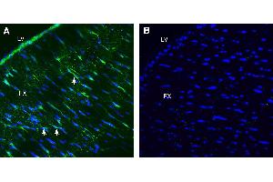 Expression of LRRC33 in rat fornix.