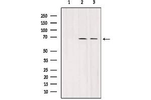 Western blot analysis of extracts from various samples, using SLC7A3 Antibody. (SLC7A3 antibody  (Internal Region))