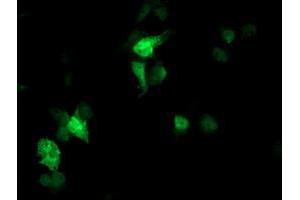 Anti-FBXO21 mouse monoclonal antibody (ABIN2455370) immunofluorescent staining of COS7 cells transiently transfected by pCMV6-ENTRY FBXO21 (RC223095). (FBXO21 antibody)