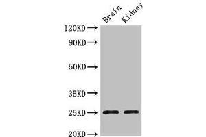 Western Blot Positive WB detected in: Mouse brain tissue, Mouse kidney tissue All lanes: CLDN10 antibody at 2. (Claudin 1 antibody  (AA 185-224))