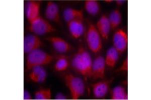 Image no. 3 for anti-Mitogen-Activated Protein Kinase Kinase Kinase 5 (MAP3K5) (Ser83) antibody (ABIN197311) (ASK1 antibody  (Ser83))