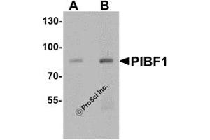 Western Blotting (WB) image for anti-Progesterone Immunomodulatory Binding Factor 1 (PIBF1) (C-Term) antibody (ABIN1077444) (PIBF1 antibody  (C-Term))