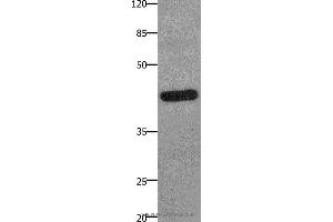 Western blot analysis of A549 cell, using PTGER2 Polyclonal Antibody at dilution of 1:100