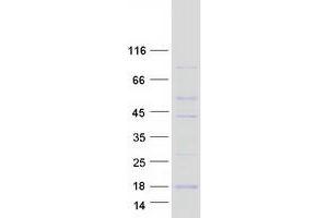 Validation with Western Blot (RBX1 Protein (Myc-DYKDDDDK Tag))