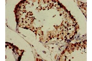 Immunohistochemistry of paraffin-embedded human testis tissue using ABIN7157142 at dilution of 1:100 (IZUMO1 antibody  (AA 22-292))