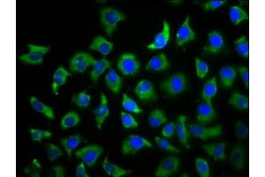 Immunofluorescence staining of A549 cells with ABIN7173750 at 1:100, counter-stained with DAPI. (TBCD antibody  (AA 2-96))