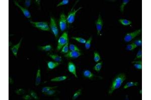Immunofluorescence staining of Hela cells with ABIN7174056 at 1:144, counter-stained with DAPI. (AXL antibody  (AA 312-447))