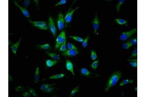 Immunofluorescence staining of Hela cells with ABIN7174056 at 1:144, counter-stained with DAPI. (AXL antibody  (AA 312-447))