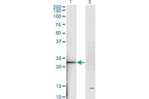 Western Blot analysis of TNNI2 expression in transfected 293T cell line by TNNI2 monoclonal antibody (M05), clone 2D5.