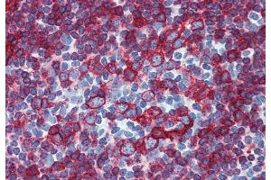 Immunohistochemistry staining of human small intestine (paraffin-embedded sections) with anti-HLA-DR+DP (HL-38). (HLA-DP/DR antibody)