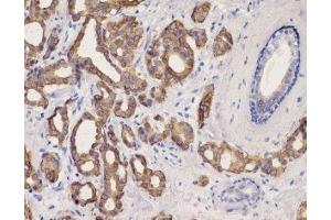 Immunohistochemistry (IHC) image for anti-Keratin 8 (KRT8) (C-Term) antibody (ABIN870548) (KRT8 antibody  (C-Term))