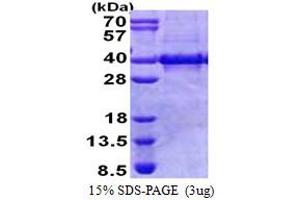 SDS-PAGE (SDS) image for Myozenin 1 (MYOZ1) (AA 1-299) protein (His tag) (ABIN5853159) (Myozenin 1 Protein (MYOZ1) (AA 1-299) (His tag))