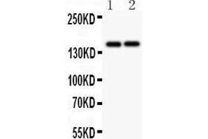 Western Blotting (WB) image for anti-Protein tyrosine Phosphatase, Receptor Type, C (PTPRC) (AA 1113-1304) antibody (ABIN3043913)