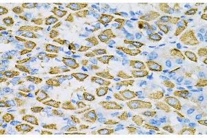 Immunohistochemistry (Paraffin-embedded Sections) (IHC (p)) image for anti-Ephrin A1 (EFNA1) antibody (ABIN7261293)