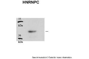 anti-Heterogeneous Nuclear Ribonucleoprotein C (C1/C2) (HNRNPC) (Middle Region) antibody