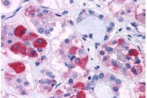 Immunohistochemistry (IHC) image for anti-Corticotropin Releasing Hormone Receptor 1 (CRHR1) (N-Term) antibody (ABIN1048463)