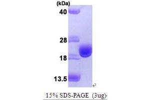 SDS-PAGE (SDS) image for Thioredoxin (TXN) (AA 1-105) protein (His tag) (ABIN666978) (TXN Protein (AA 1-105) (His tag))