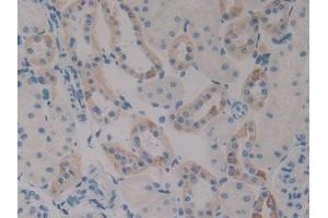 #VALUE! (PLAU antibody  (AA 17-432))