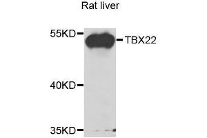 Western blot analysis of extracts of rat liver, using TBX22 antibody. (T-Box 22 antibody  (AA 291-520))