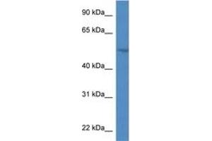 Image no. 1 for anti-Sphingomyelin phosphodiesterase, Acid-Like 3A (SMPDL3A) (AA 82-131) antibody (ABIN6746346) (SMPDL3A antibody  (AA 82-131))