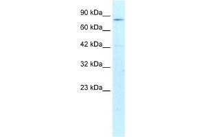 WB Suggested Anti-CREBL1 Antibody Titration:  1. (ATF6B antibody  (N-Term))