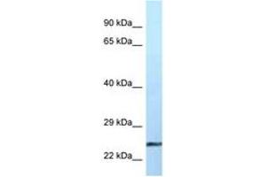 Image no. 1 for anti-Ephrin A2 (EFNA2) (AA 76-125) antibody (ABIN6747487) (Ephrin A2 antibody  (AA 76-125))