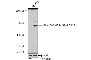 Western blot analysis of extracts of various cell lines, using Phospho-P/2/3-S144/S141/S139 Rabbit mAb (ABIN7269150) at 1:1000 dilution. (PAK1/2/3 antibody  (pSer139, pSer141, pSer144))