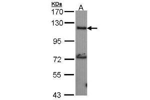 WB Image Sample (30 ug of whole cell lysate) A: IMR32 7. (ADCY2 antibody)