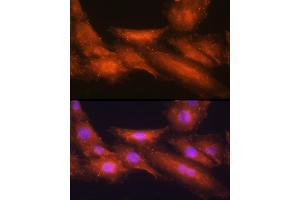 Immunofluorescence analysis of H9C2 cells using [KO Validated] HINT1 Rabbit pAb  at dilution of 1:100 (40x lens). (HINT1 antibody  (AA 1-126))