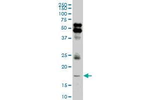 LMO2 monoclonal antibody (M05), clone 4D3. (LMO2 antibody  (AA 16-102))