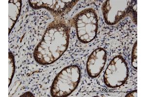 Immunoperoxidase of monoclonal antibody to ACOT7 on formalin-fixed paraffin-embedded human colon. (ACOT7 antibody  (AA 1-338))