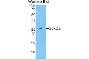 Western Blotting (WB) image for anti-Laminin, beta 2 (Laminin S) (LAMB2) (AA 1498-1716) antibody (ABIN1859603) (LAMB2 antibody  (AA 1498-1716))