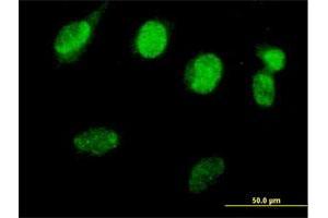 Immunofluorescence of purified MaxPab antibody to RAD51L3 on HeLa cell.