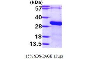 SDS-PAGE (SDS) image for Regulator of G-Protein Signalling 19 (RGS19) (AA 1-217) protein (His tag) (ABIN667286)