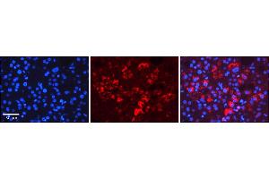 Rabbit Anti-TAPBP Antibody    Formalin Fixed Paraffin Embedded Tissue: Human Adult liver  Observed Staining: Cytoplasmic Primary Antibody Concentration: 1:600 Secondary Antibody: Donkey anti-Rabbit-Cy2/3 Secondary Antibody Concentration: 1:200 Magnification: 20X Exposure Time: 0. (TAPBP antibody  (C-Term))