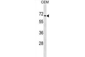 ZNF93 Antibody (N-term) (ABIN1882040 and ABIN2838921) western blot analysis in CEM cell line lysates (35 μg/lane). (ZNF93 antibody  (N-Term))