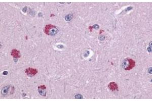 Immunohistochemical (Formalin/PFA-fixed paraffin-embedded sections) staining in human brain, neurons with TAAR1 polyclonal antibody . (TAAR1 antibody  (2nd Extracellular Domain))