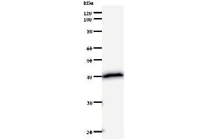 Western Blotting (WB) image for anti-SATB Homeobox 2 (SATB2) antibody (ABIN932998)