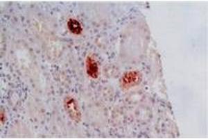 Immunohistochemistry (IHC) image for anti-HLA Class I Histocompatibility Antigen, alpha Chain G (HLAG) antibody (ABIN238485) (HLAG antibody)