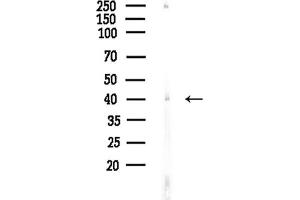 anti-Acyl-CoA Dehydrogenase, C-2 To C-3 Short Chain (Acads) (C-Term) antibody