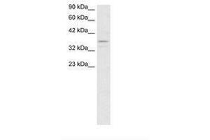 Image no. 3 for anti-TAF7 RNA Polymerase II, TATA Box Binding Protein (TBP)-Associated Factor, 55kDa (TAF7) (N-Term) antibody (ABIN202307) (TAF7 antibody  (N-Term))