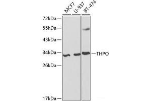 Western blot analysis of extracts of various cell lines using THPO Polyclonal Antibody at dilution of 1:1000. (Thrombopoietin antibody)