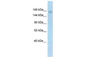 Western Blot showing Utx antibody used at a concentration of 1.
