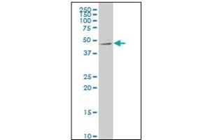 Western Blotting (WB) image for anti-Netrin G2 (NTNG2) (AA 21-120) antibody (ABIN614733) (Netrin G2 antibody  (AA 21-120))