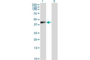 Western Blot analysis of EMILIN1 expression in transfected 293T cell line by EMILIN1 monoclonal antibody (M01), clone 4A3.