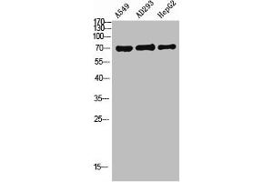 Western Blot analysis of A549 AD293 HEPG2 using OATP1 Polyclonal Antibody.