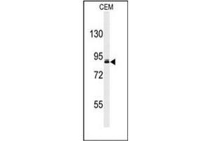Western blot analysis of URG4 Antibody (Center) in CEM cell line lysates (35ug/lane). (URGCP antibody  (Middle Region))