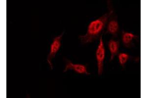 ABIN6274102 staining COLO205 by IF/ICC. (T-Box 1 antibody  (C-Term))